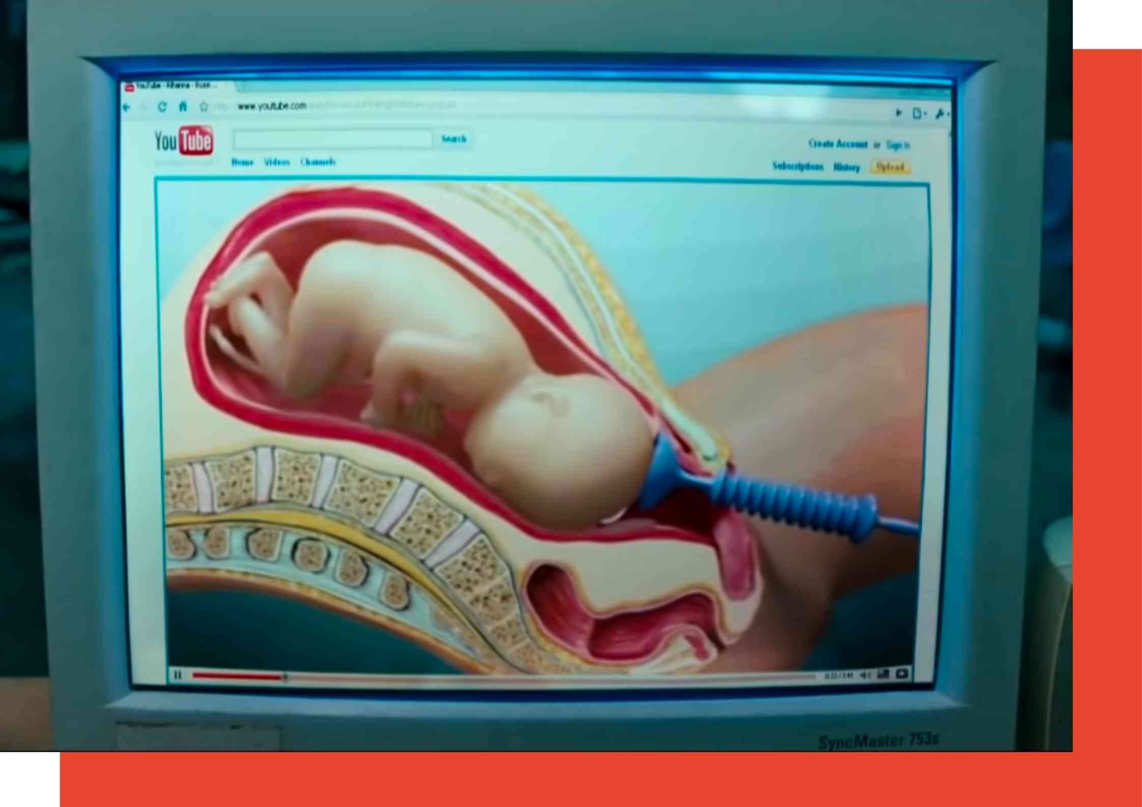 whiteboard animation video is a category of explainer video, that reminds people of a teacher explaining a concept